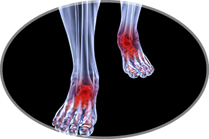 arthritic foot & ankle care