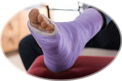foot and ankle fractures
